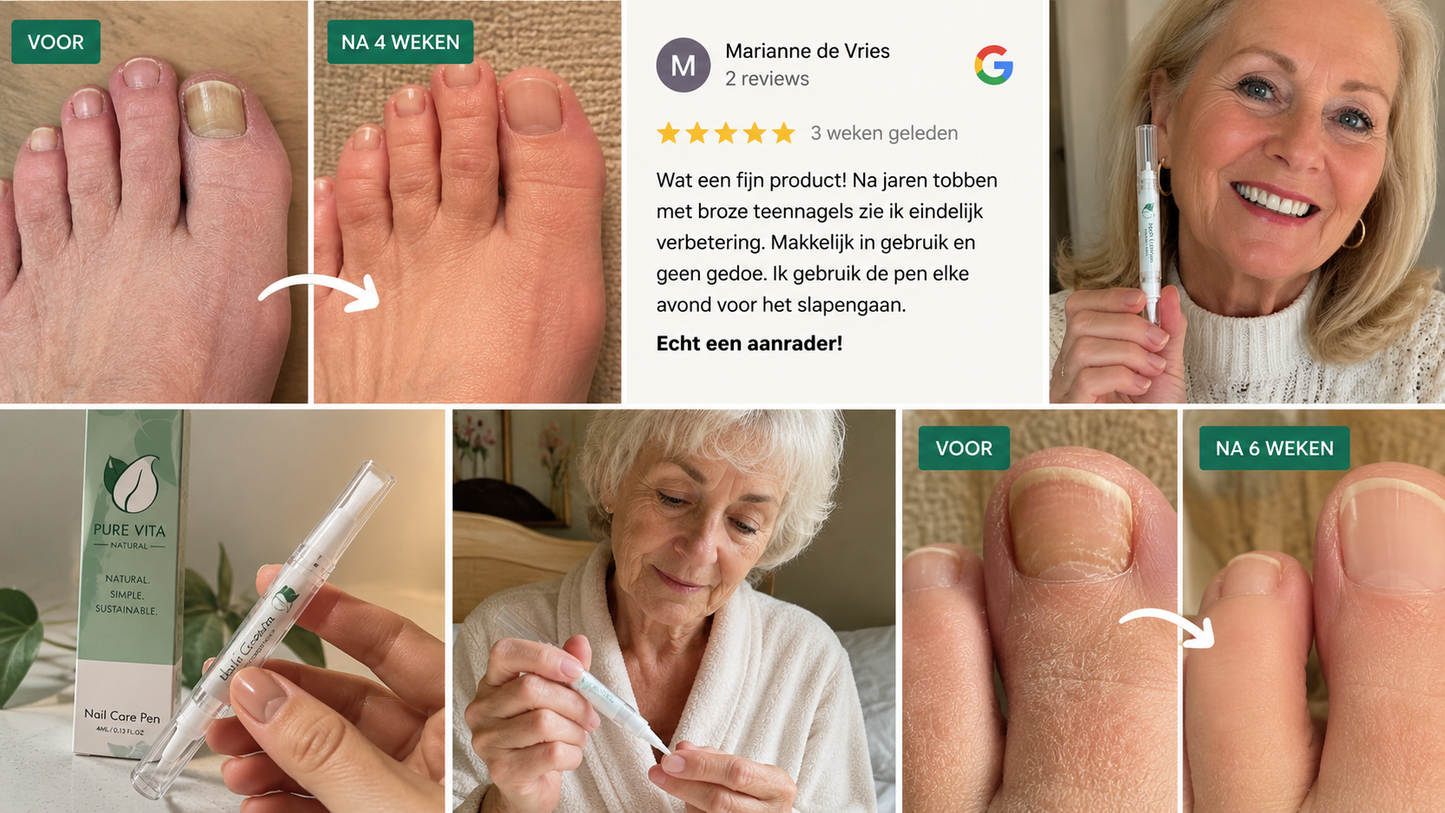 Nagelverzorgingspen