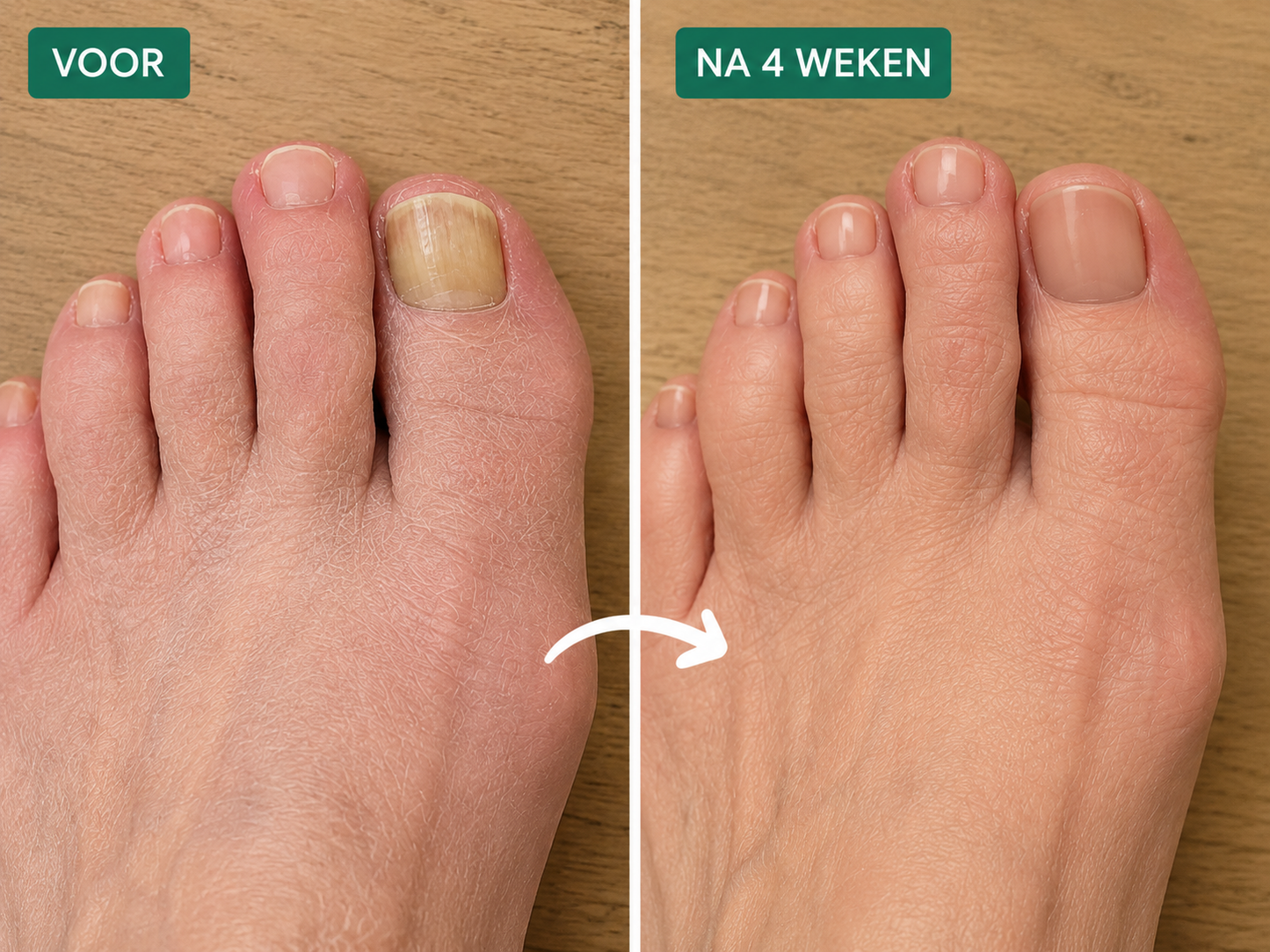 Nagelverzorgingspen